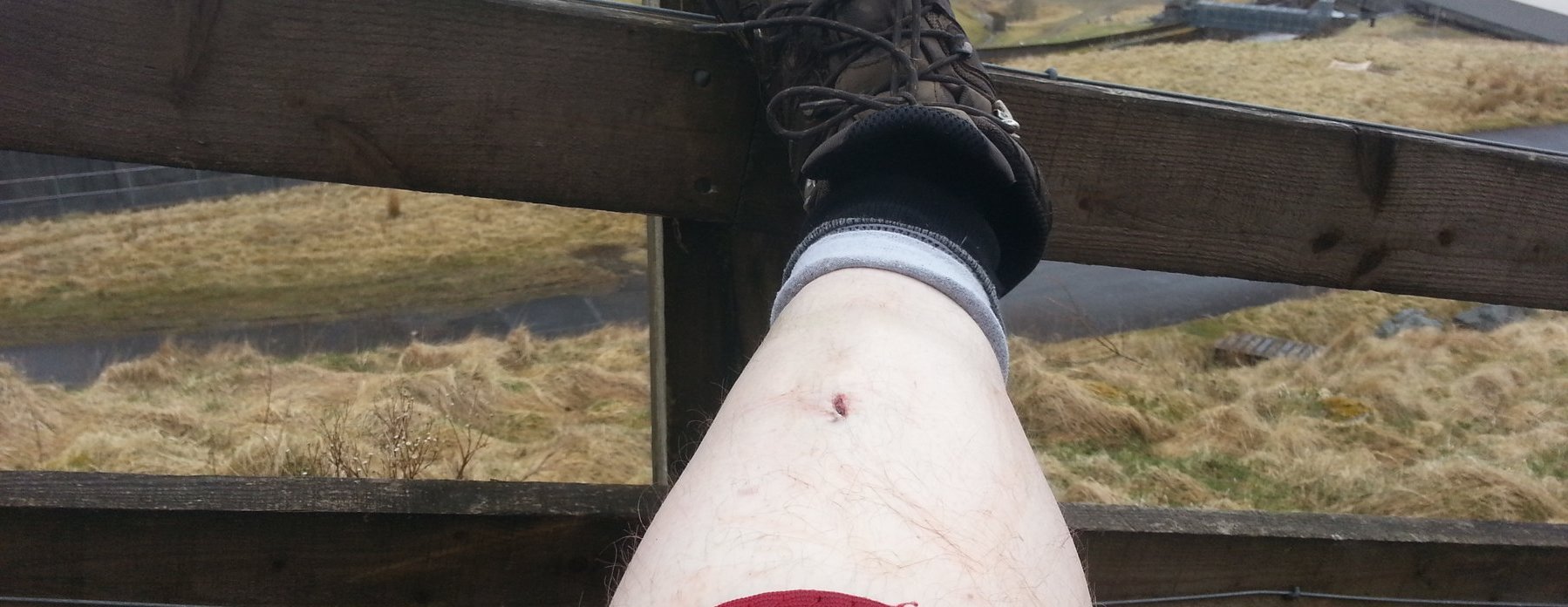 Schoolboy error as I trip on the way up Sweetshaw Brae and cut my leg deeply